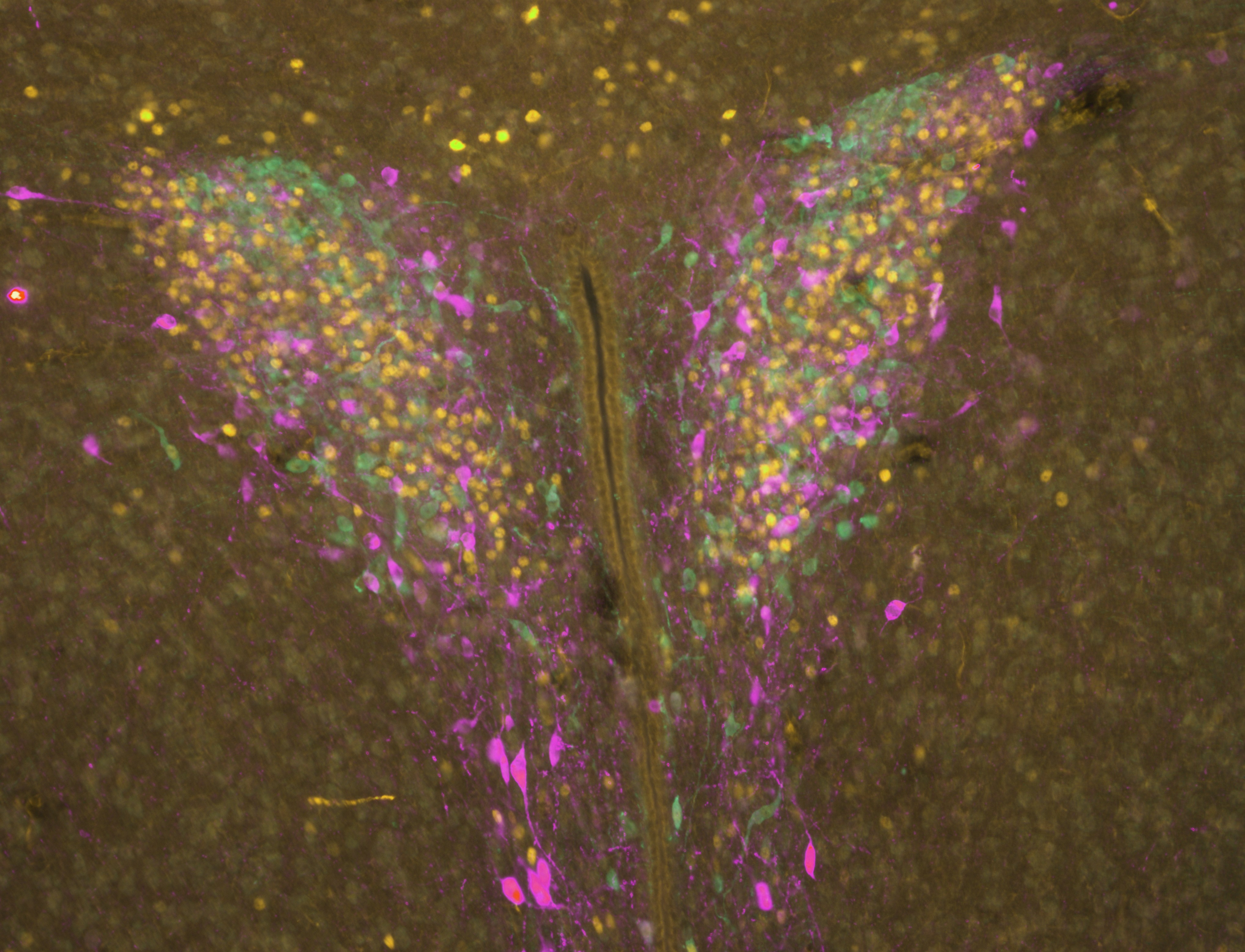 IFC immunofluorescence image